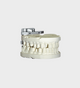 iTero articulator