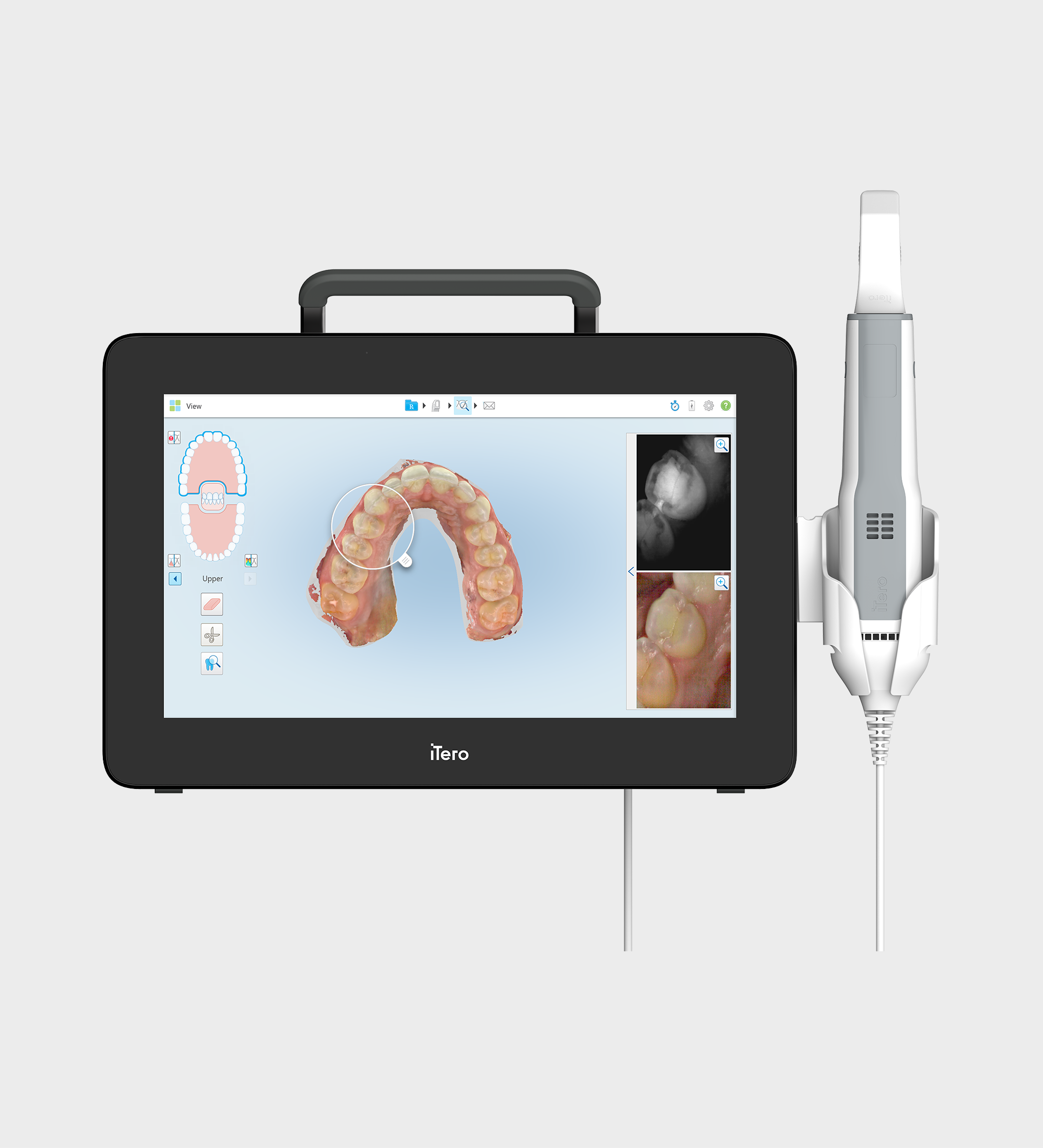 Try before you buy an iTero™ Element 5D Plus Mobile Scanner – iTero Store